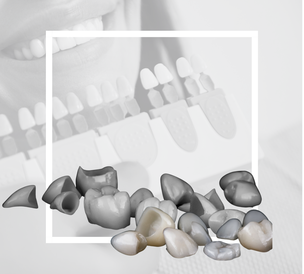 Dental Crowns